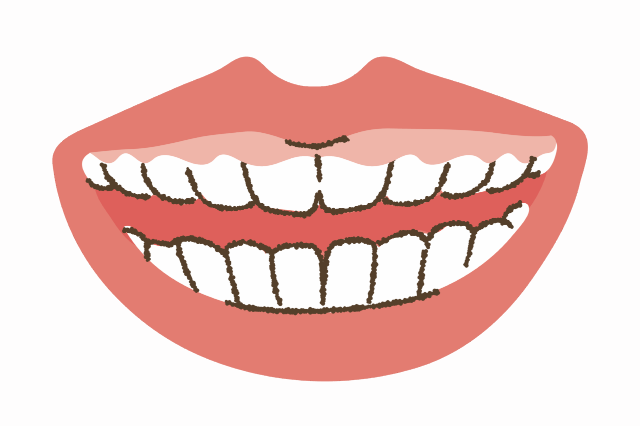 じつは関係してる！歯並びとお口の筋力・姿勢