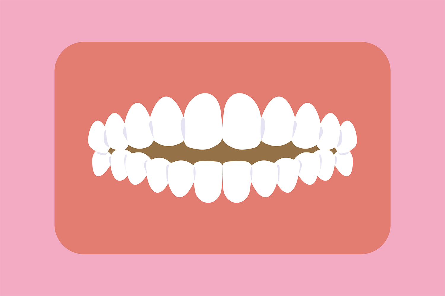 こどもの歯並びが心配…矯正は必要？良くする方法はある？