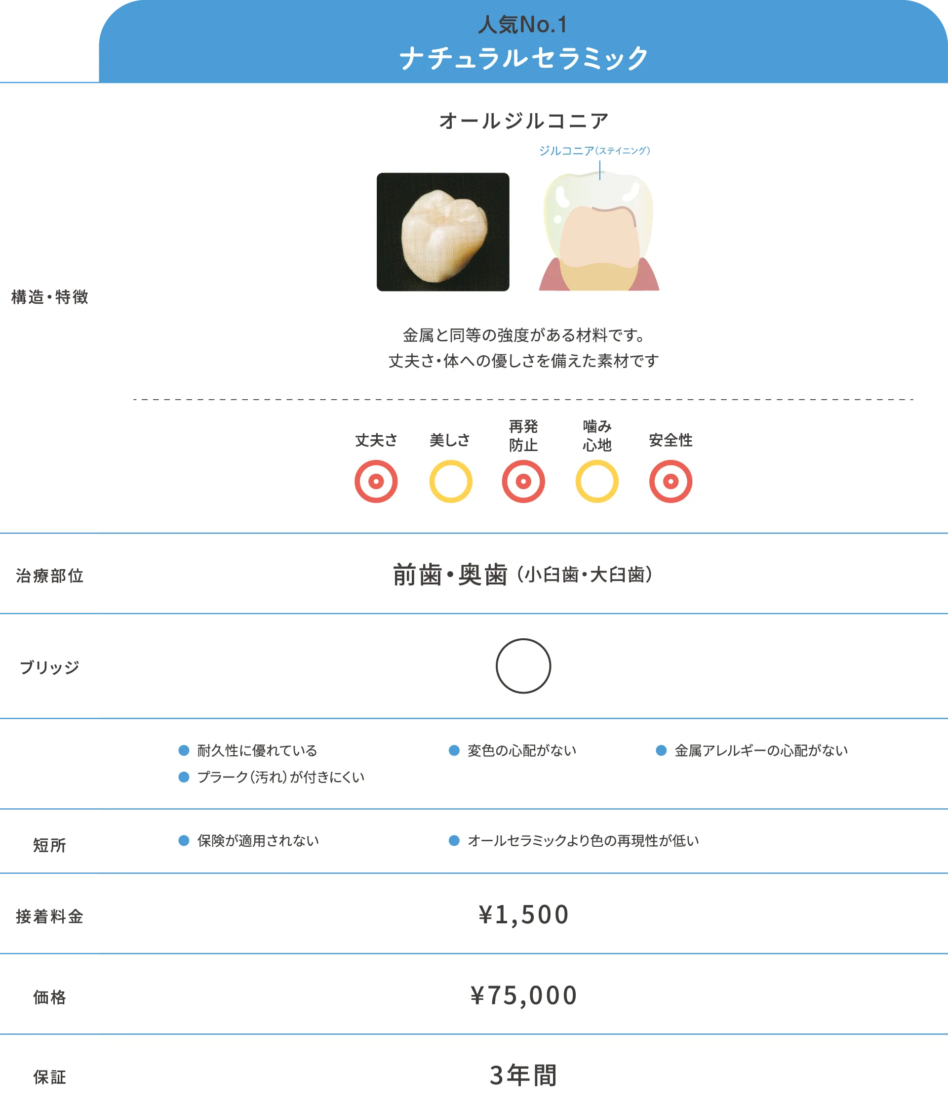 補綴物スタンダード素材ナチュラルセラミック詳細
