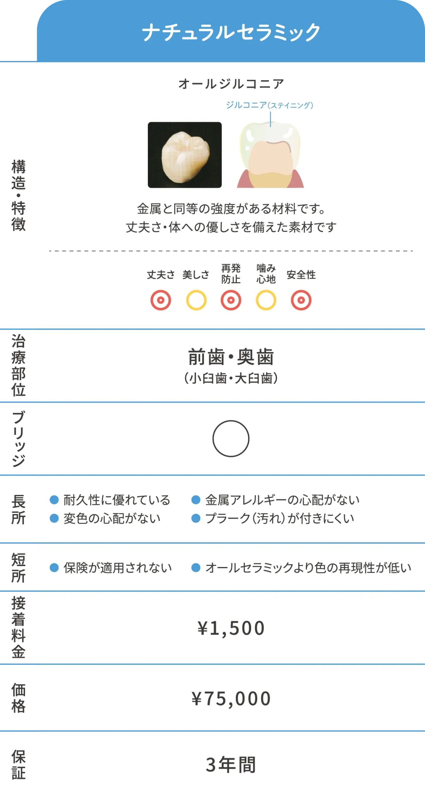 補綴物スタンダード素材ナチュラルセラミック詳細