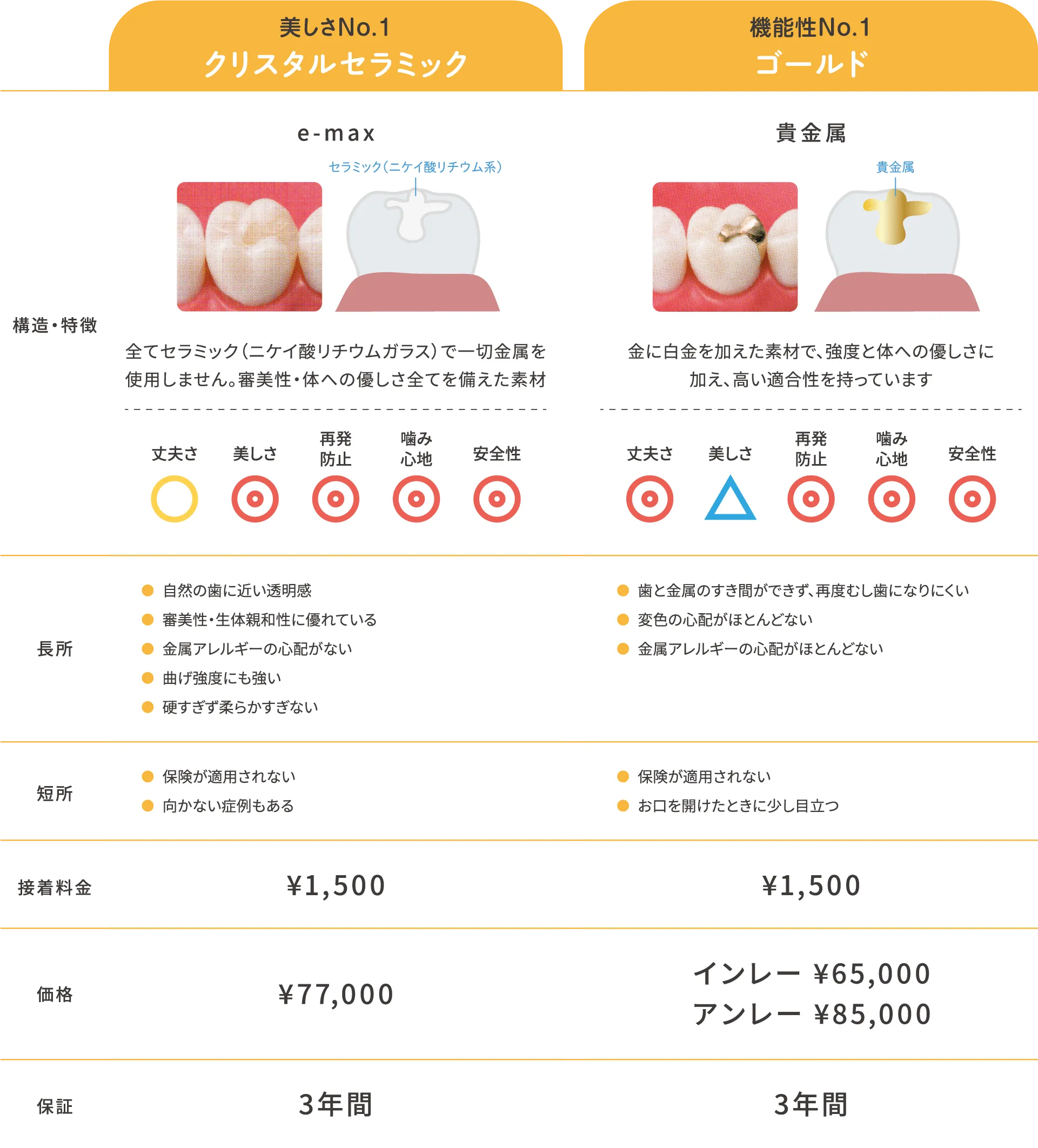 詰め物(インレー)ハイグレード素材詳細