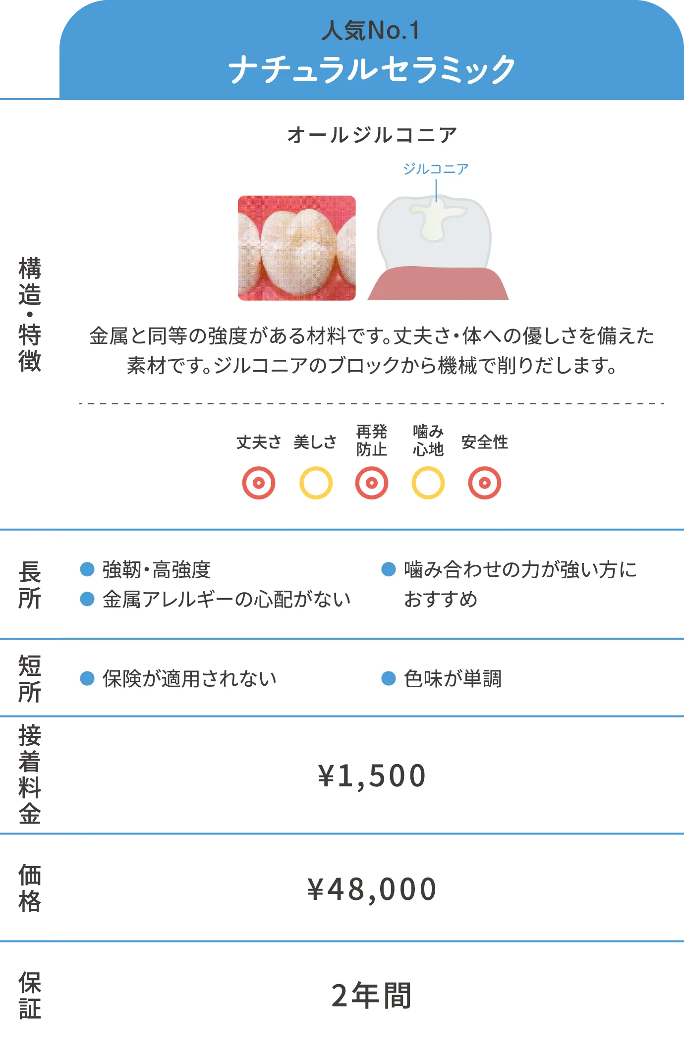 詰め物(インレー)スタンダード素材詳細